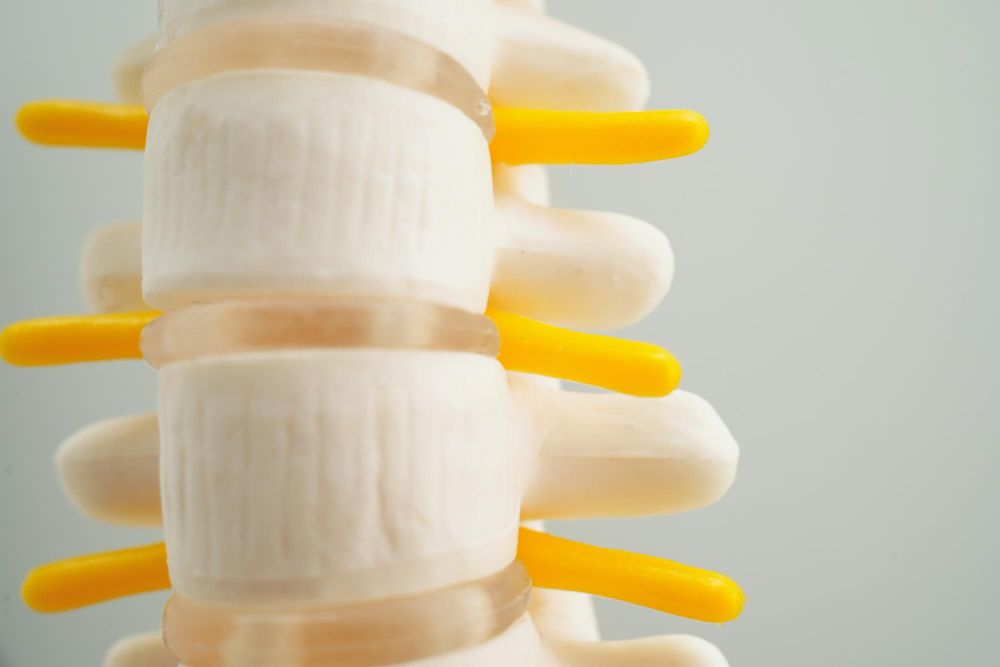 Degenerative Disc Disease  Lima, OH,